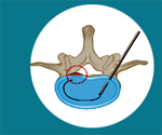 Cheap and Affordable Spine Surgery in India, Best Hospitals for Spine Surgery in India, Best Doctors for Spine Surgery in India , Medkaizen Global, Apollo Hospitals, Fortis Hospitals, Max Hospitals, Artemis Hospitals, Medanta Hospitals, Manipal Hospitals, Hospitals for Medical Tourism in India, Hospital for Medical Treatment in India, Hospitals for Surgery in India, Medical Tourism in India, Medical Treatment in India, Surgery in India, Medical Tourism Company
