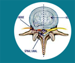 Cheap and Affordable Spine Surgery in India, Best Hospitals for Spine Surgery in India, Best Doctors for Spine Surgery in India , Medkaizen Global, Apollo Hospitals, Fortis Hospitals, Max Hospitals, Artemis Hospitals, Medanta Hospitals, Manipal Hospitals, Hospitals for Medical Tourism in India, Hospital for Medical Treatment in India, Hospitals for Surgery in India, Medical Tourism in India, Medical Treatment in India, Surgery in India, Medical Tourism Company