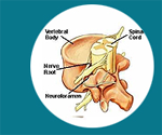 Cheap and Affordable Spine Surgery in India, Best Hospitals for Spine Surgery in India, Best Doctors for Spine Surgery in India , Medkaizen Global, Apollo Hospitals, Fortis Hospitals, Max Hospitals, Artemis Hospitals, Medanta Hospitals, Manipal Hospitals, Hospitals for Medical Tourism in India, Hospital for Medical Treatment in India, Hospitals for Surgery in India, Medical Tourism in India, Medical Treatment in India, Surgery in India, Medical Tourism Company